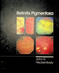 Retinitis Pigmentosa