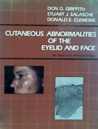 CUTANEOUS ABNORMALITIES OF THE EYELID AND FACE, An Atlas with Histopathology