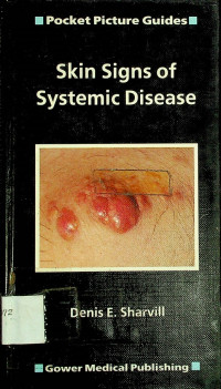 Skin Signs of Systemic Disease; Pocket Picture Guides