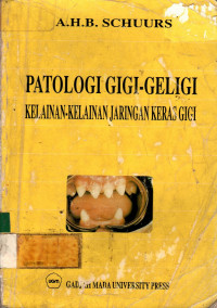 PATOLOGI GIGI-GELIGI KELAINAN-KELAINAN JARINGAN KERAS GIGI