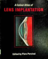 A Colour Atlas of LENS IMPLANTATION