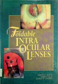 Foldable INTRA OCULAR LENSES