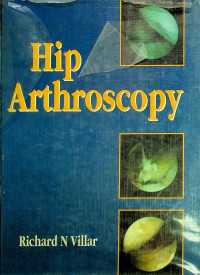 Hip Arthroscopy