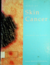 Atlas of Skin Cancer