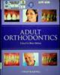 ADULT ORTHODONTICS