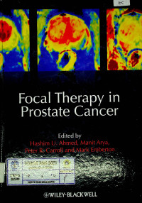 Focal Therapy in Prostate Cancer