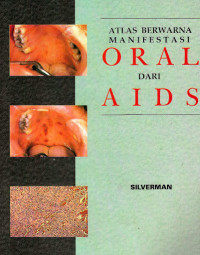 ATLAS BERWARNA : MANIFESTASI ORAL DARI AIDS