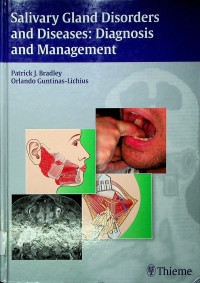 Salivary Gland Disorders and Diseases: Diagnosis and Management