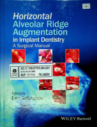 Horizontal Alveolar Ridge Augmentation in Implant Dentistry : A Surgical Manual