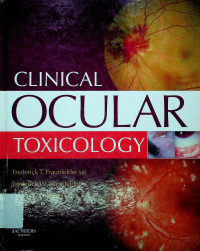CLINICAL OCULAR TOXICOLOGY